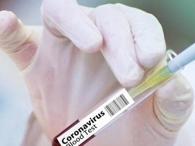 COVID-19: Vaccine is Africa research priority