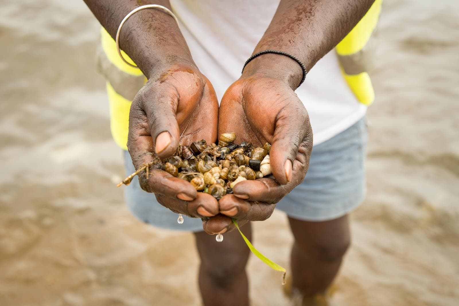 Concerted Efforts Needed to Eliminate Bilharzia in Africa